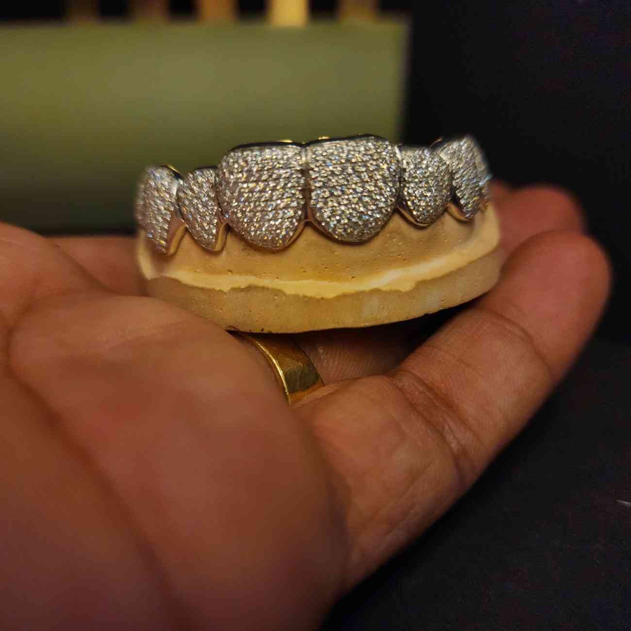 Customized Full Iced Out Hip Hop Diamond grillz Alternate View