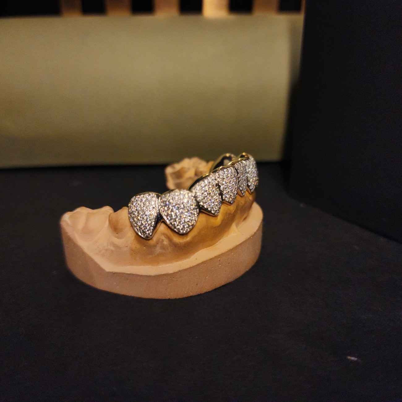 Men's Hip Hop Diamond Custom Grillz Set Alternate View