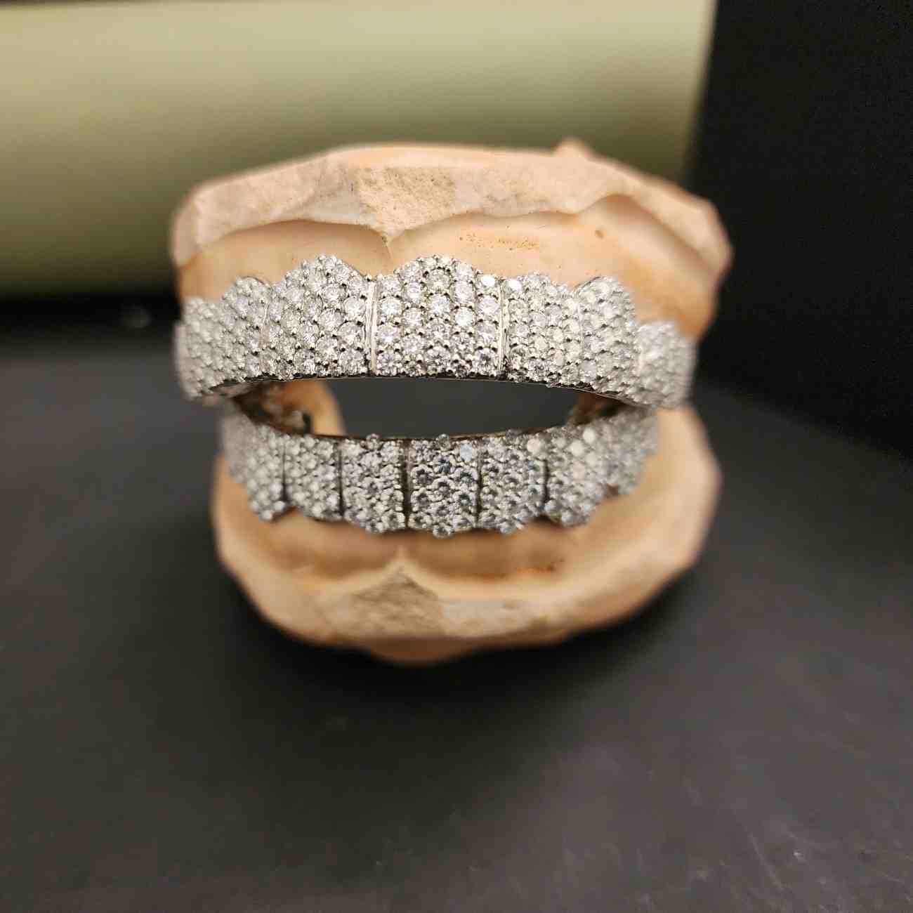 Custom Diamond Grillz Set – Iced Out Hip Hop Jewelry