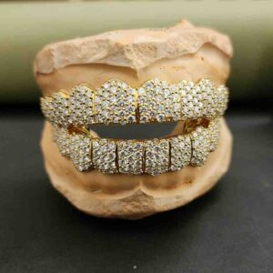 Customized Iced Out Diamond Grillz Set